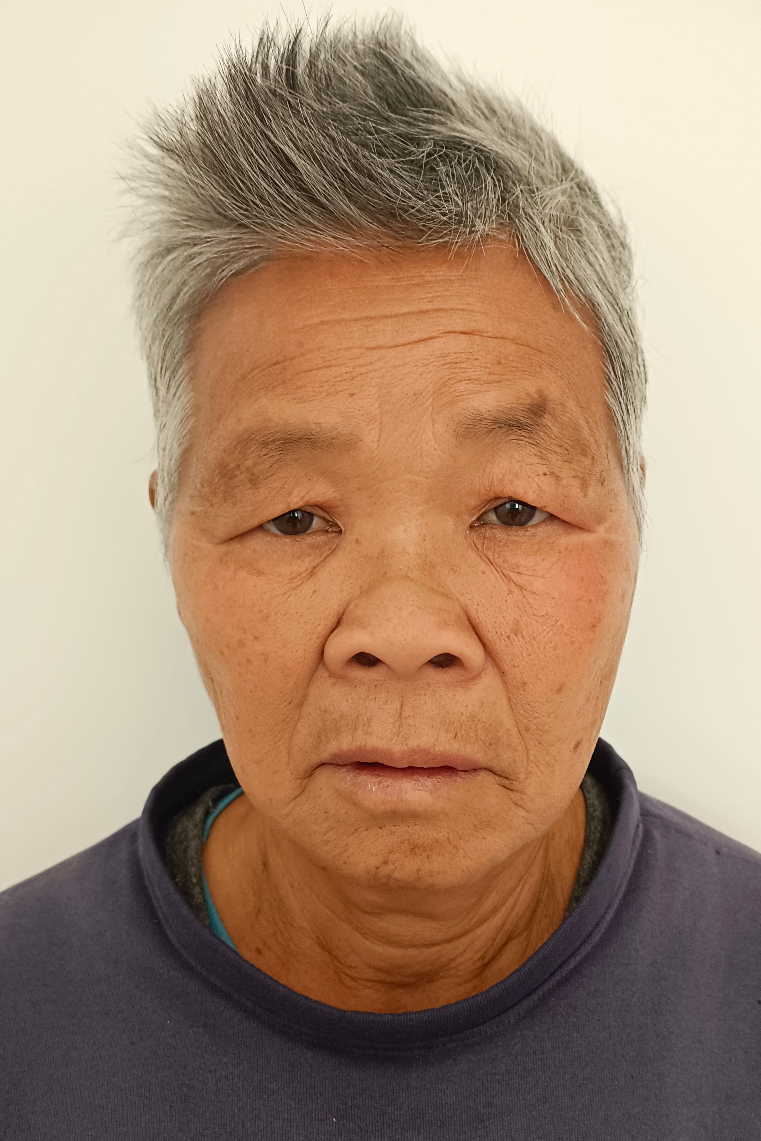 走失者照片 全国救助站