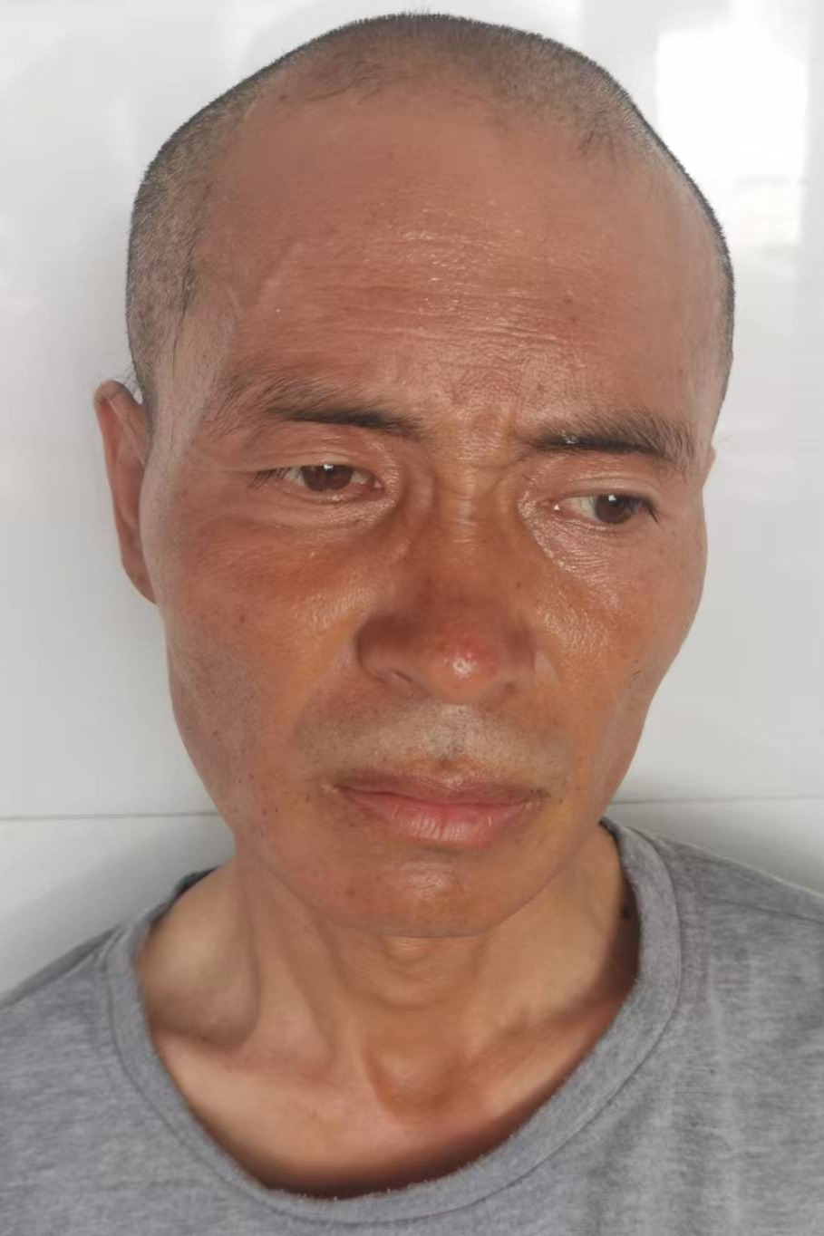 走失者照片 全国救助站