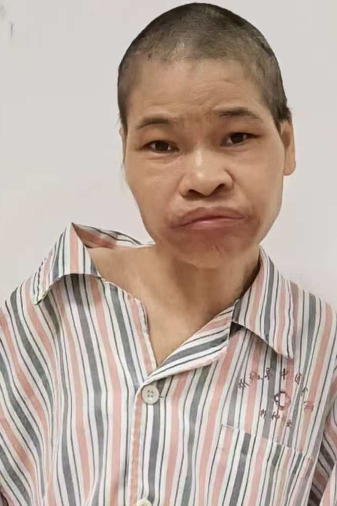 走失者照片 全国救助站