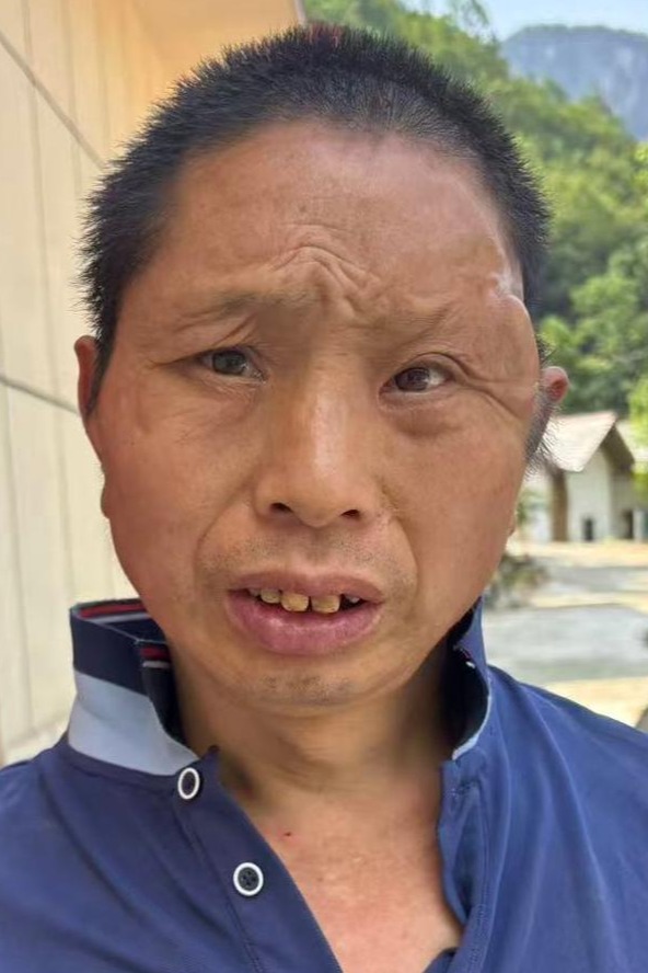 走失者照片 全国救助站