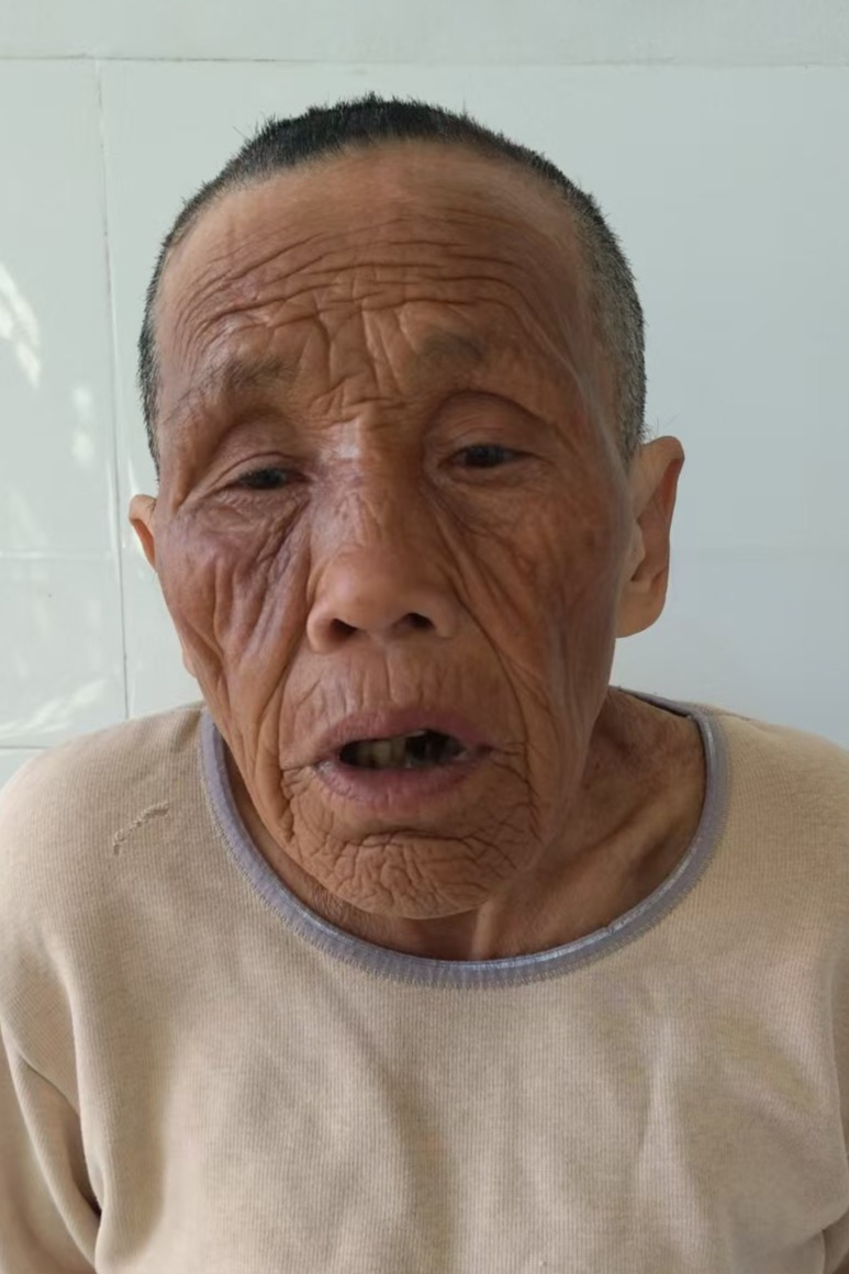走失者照片 全国救助站
