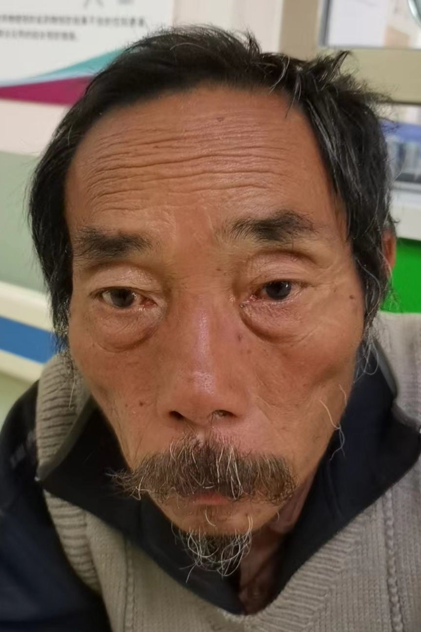 走失者照片 全国救助站