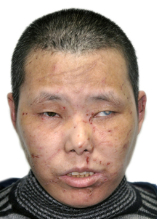 走失者照片 全国救助站