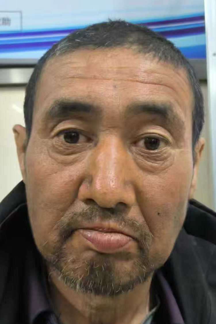走失者照片 全国救助站
