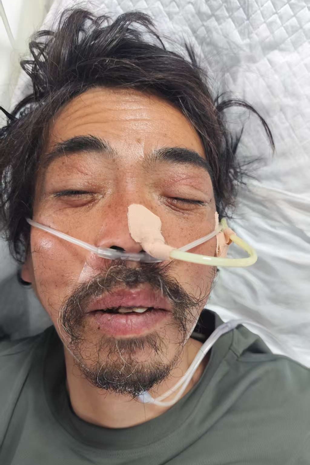 走失者照片 全国救助站