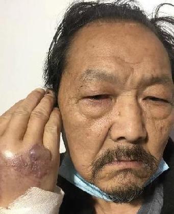 走失者照片 全国救助站