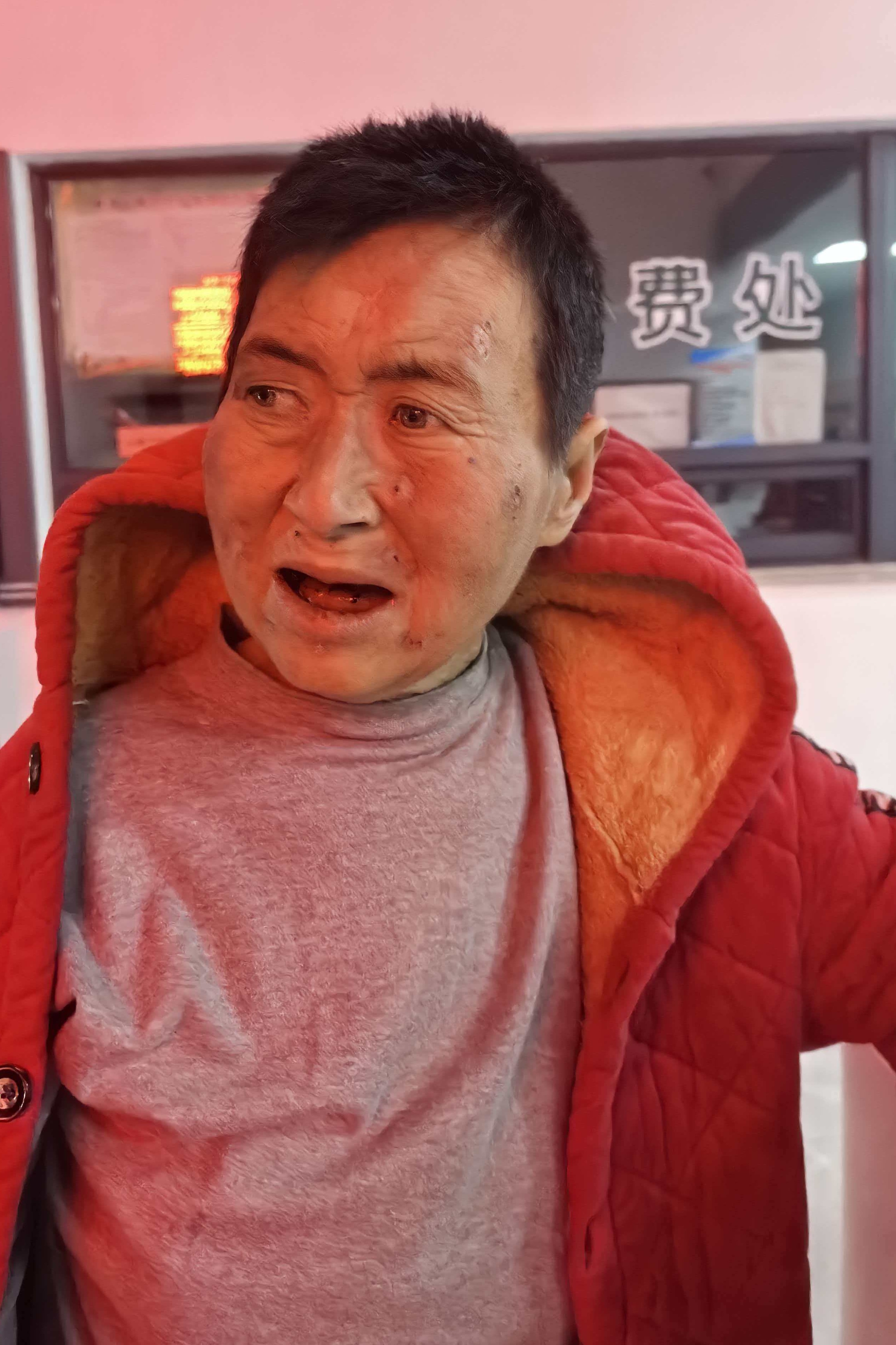 走失者照片 全国救助站