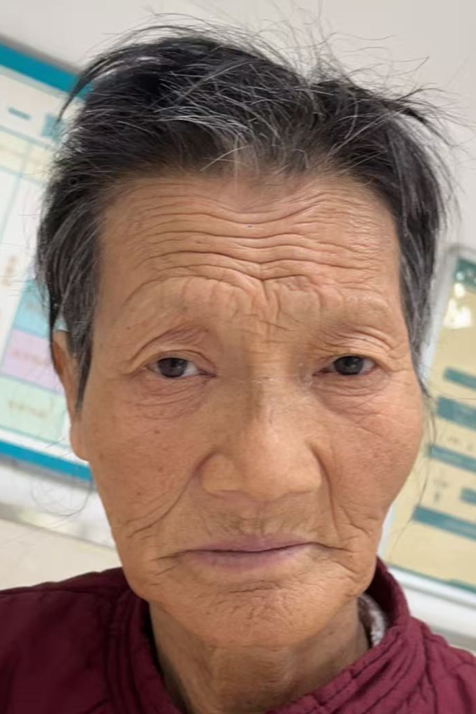 走失者照片 全国救助站