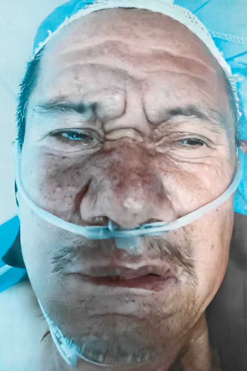 走失者照片 全国救助站