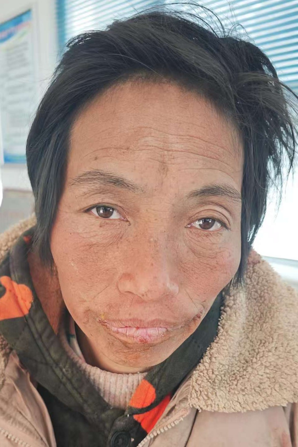 走失者照片 全国救助站