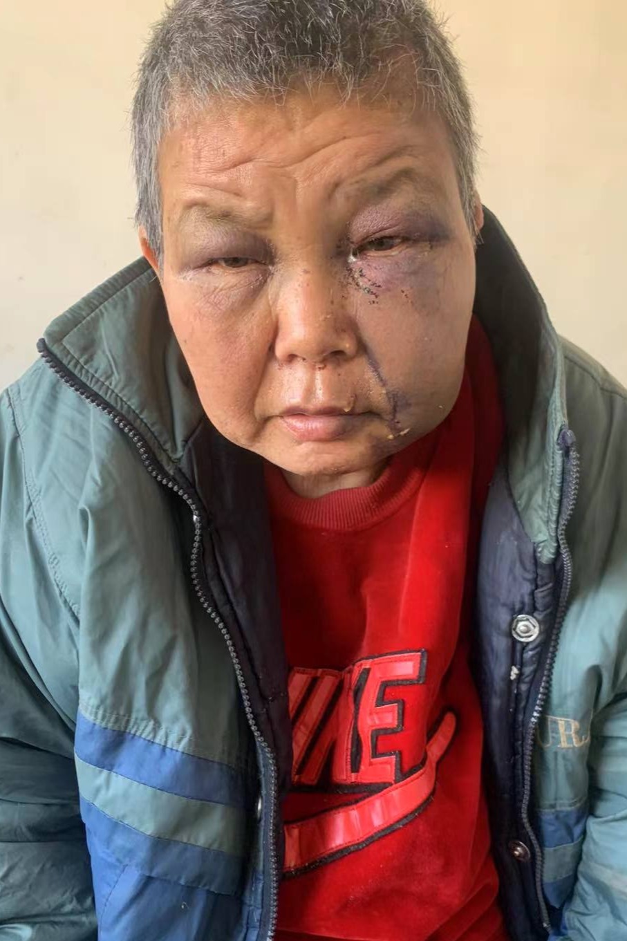 走失者照片 全国救助站
