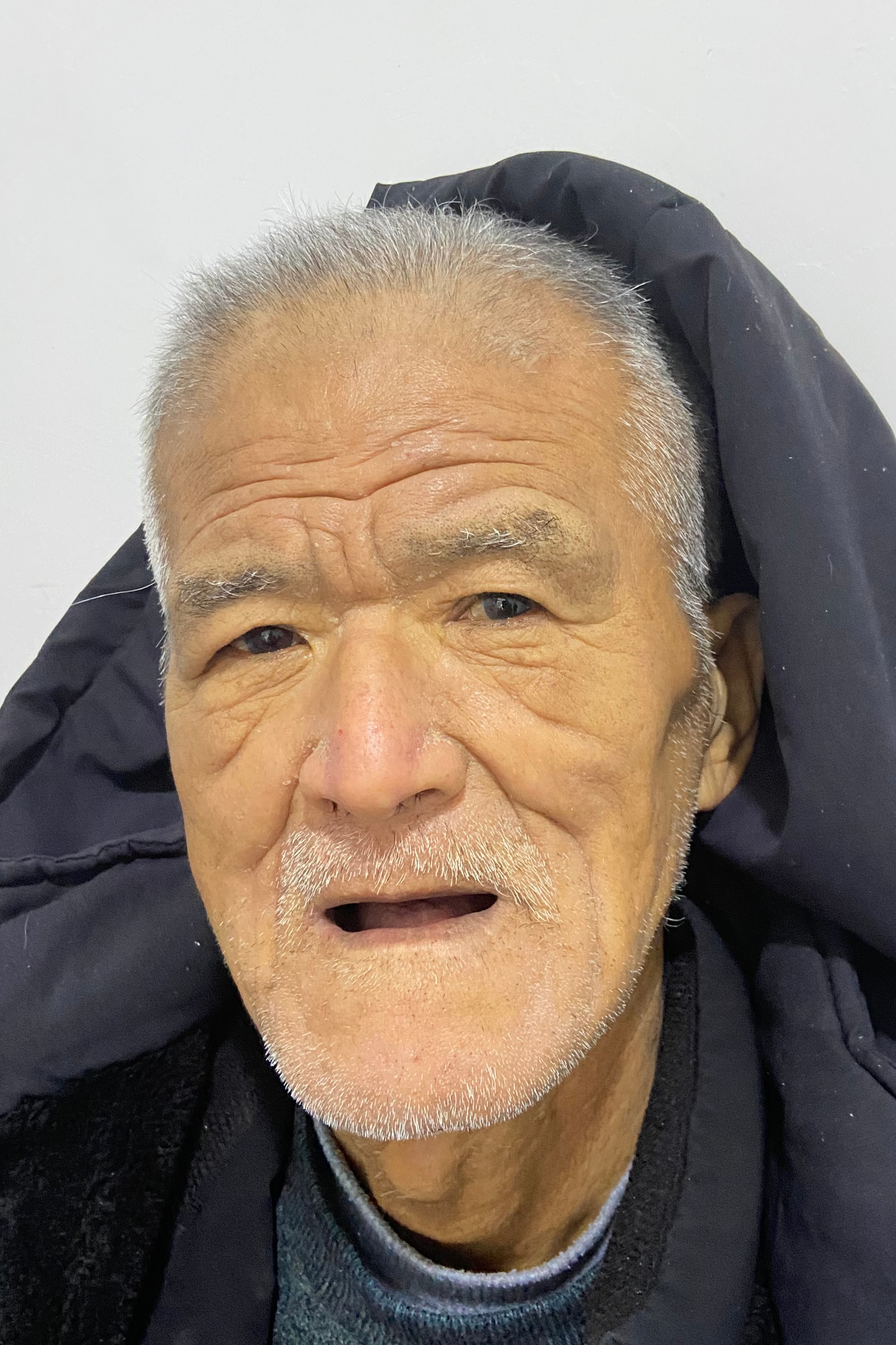 走失者照片 全国救助站