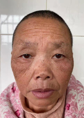 走失者照片 全国救助站