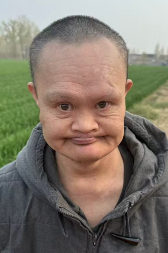 走失者照片 全国救助站