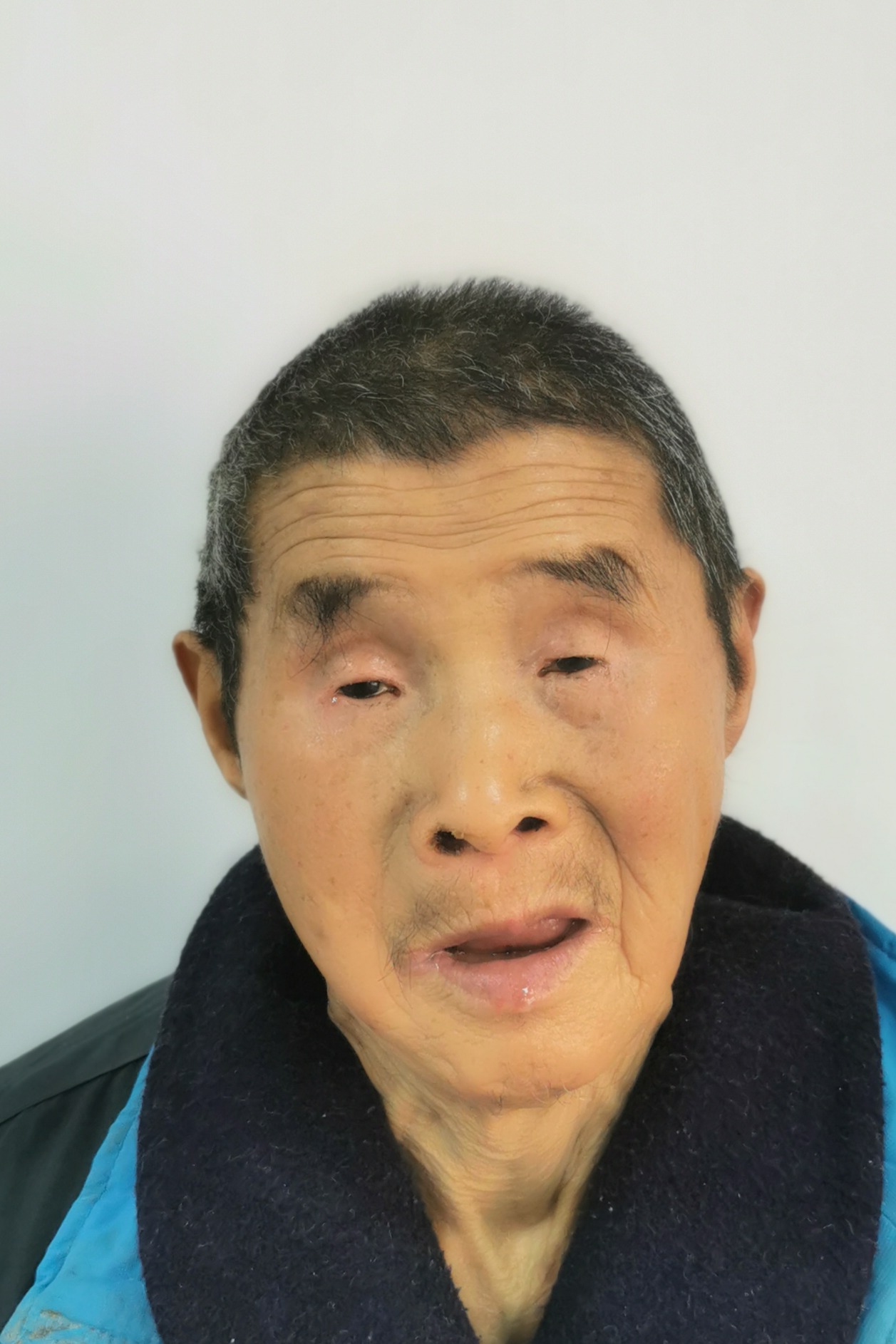 走失者照片 全国救助站