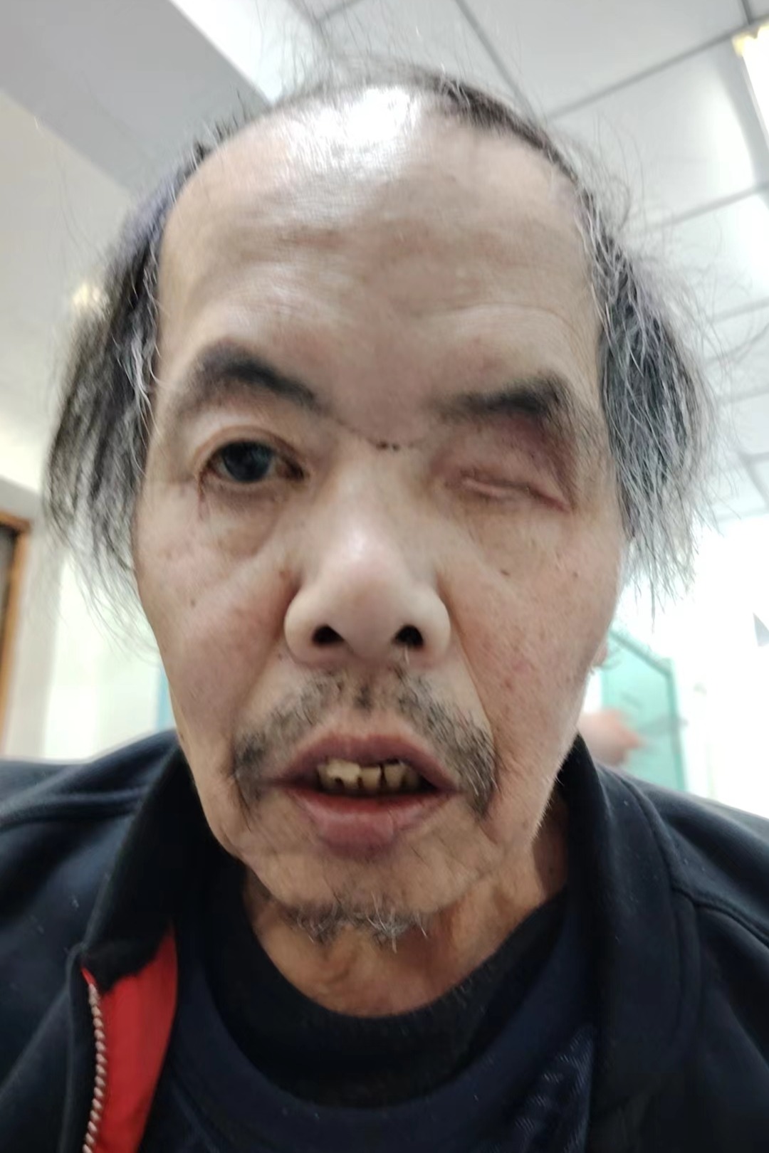 走失者照片 全国救助站