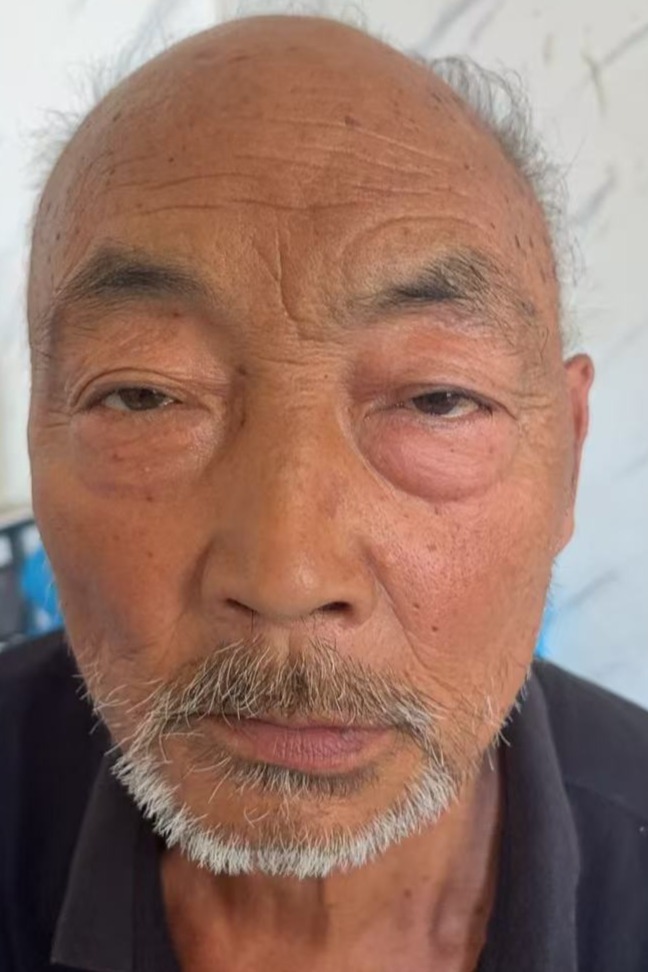 走失者照片 全国救助站