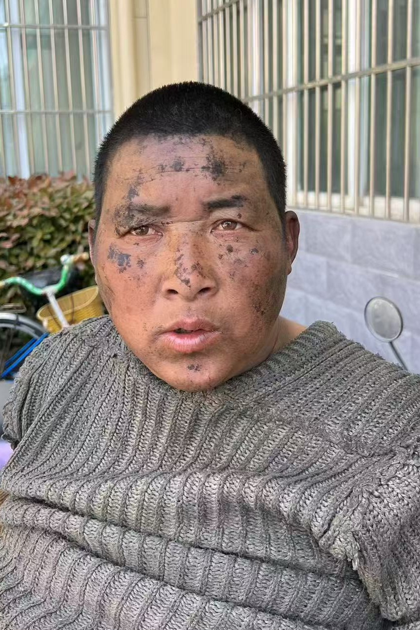 走失者照片 全国救助站