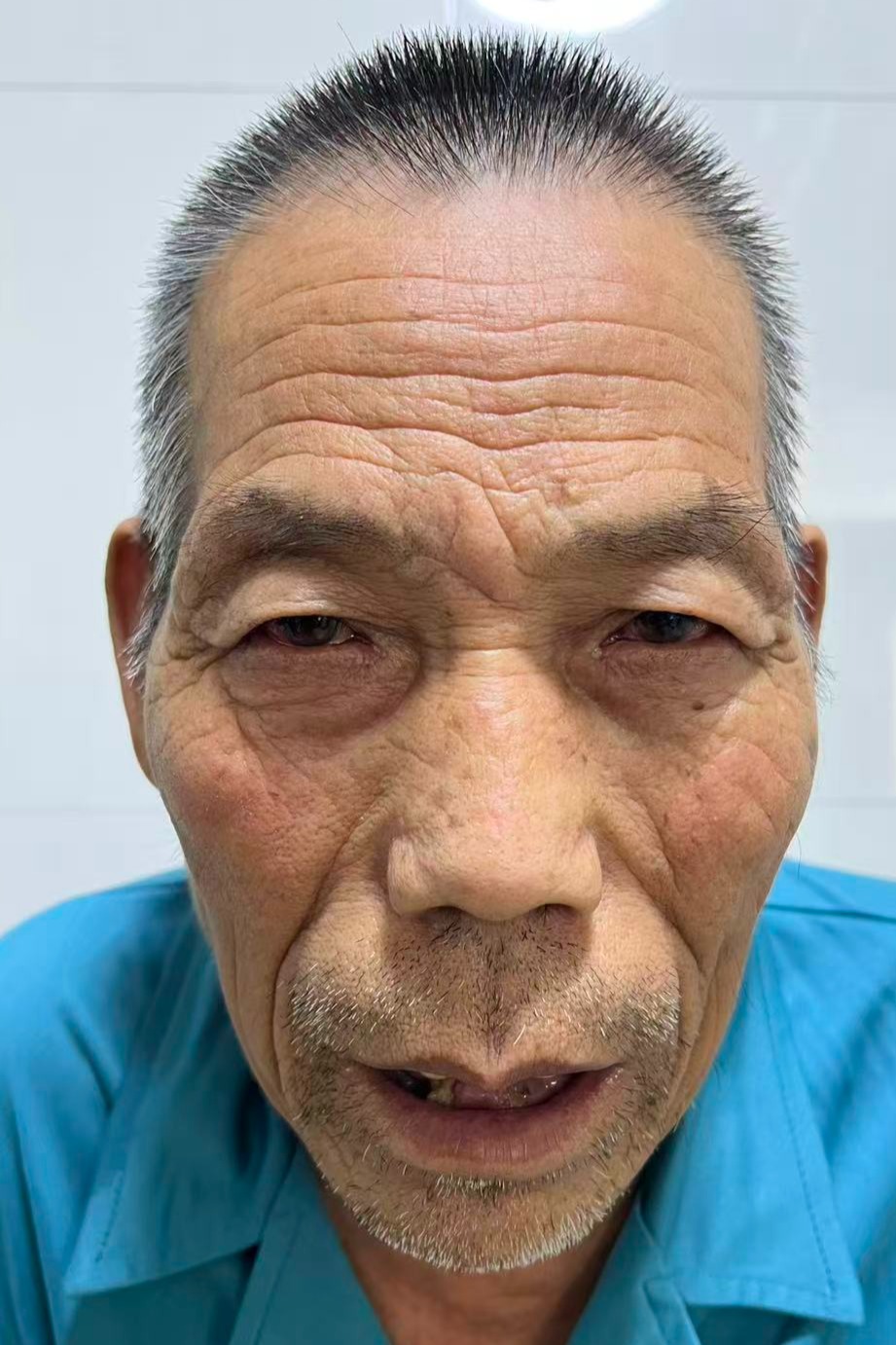 走失者照片 全国救助站