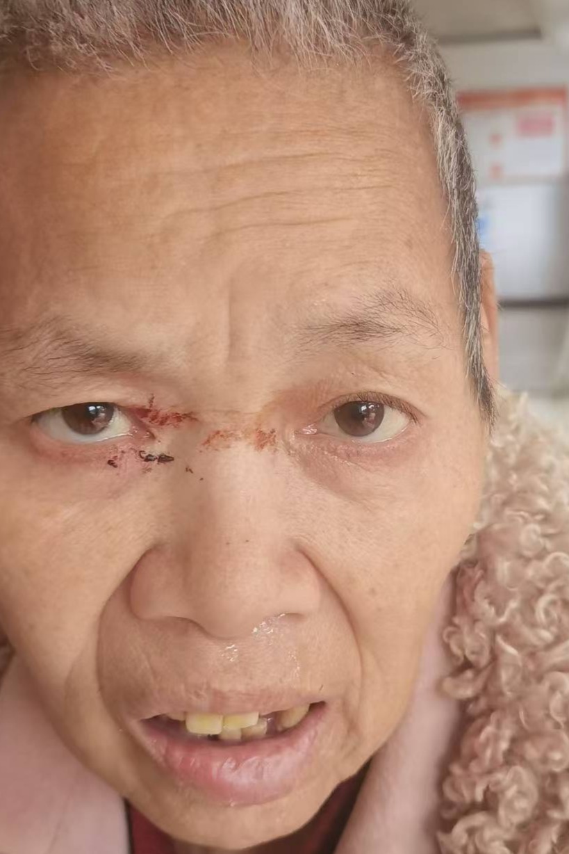 走失者照片 全国救助站