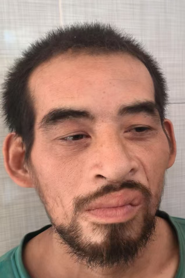 走失者照片 全国救助站
