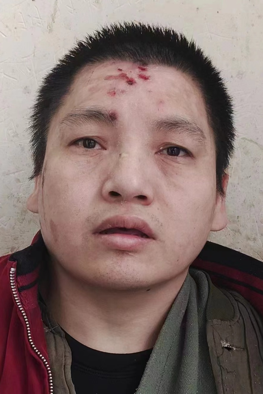 走失者照片 全国救助站