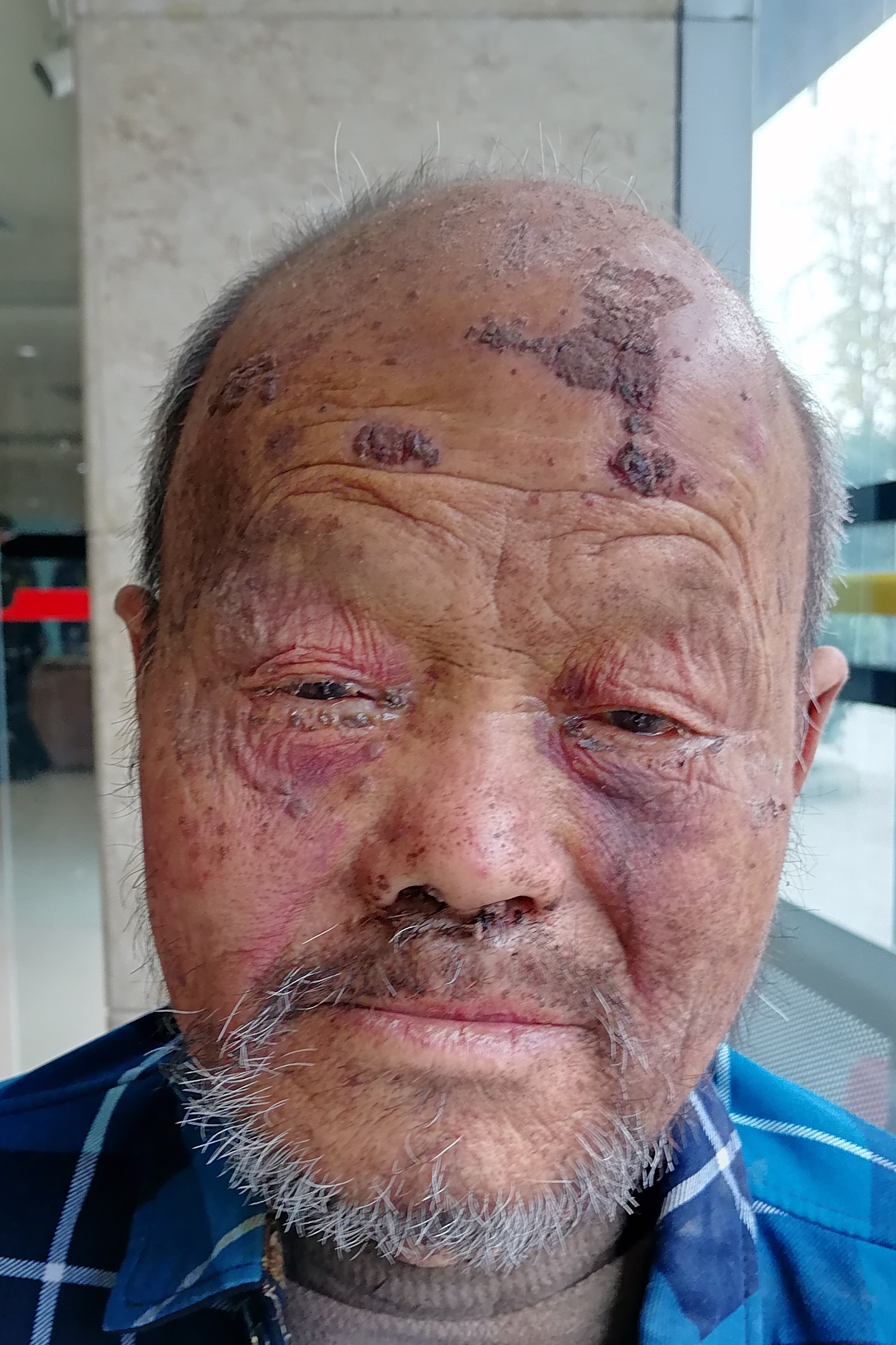 走失者照片 全国救助站