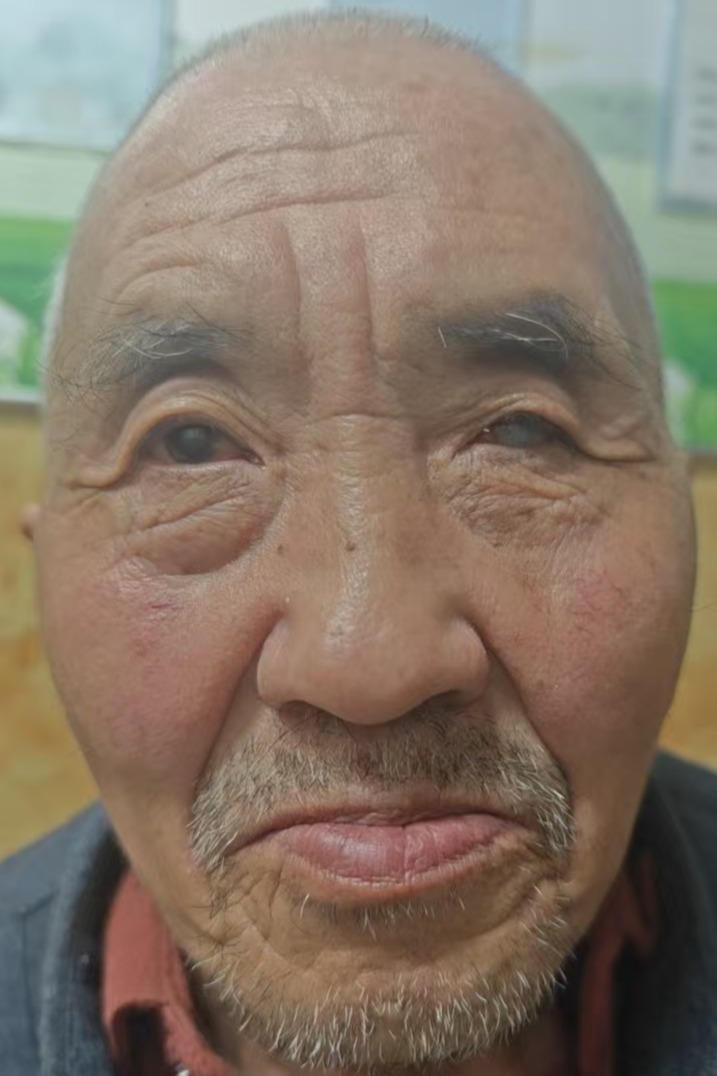 走失者照片 全国救助站