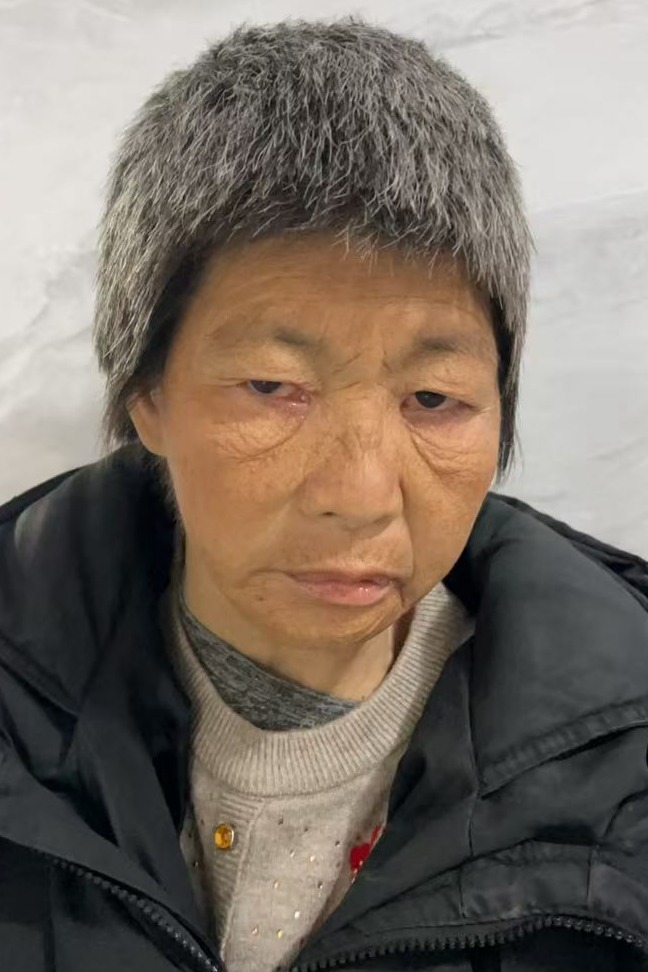 走失者照片 全国救助站