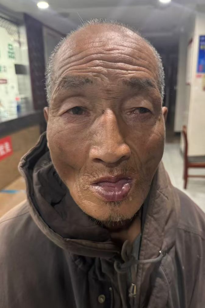 走失者照片 全国救助站