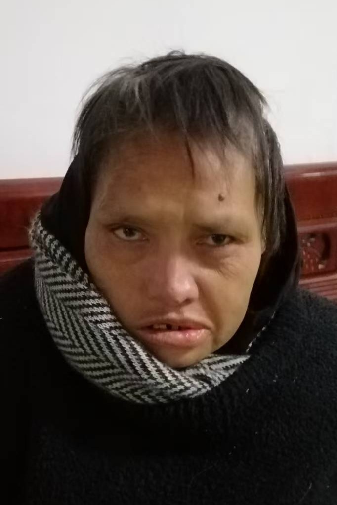 走失者照片 全国救助站
