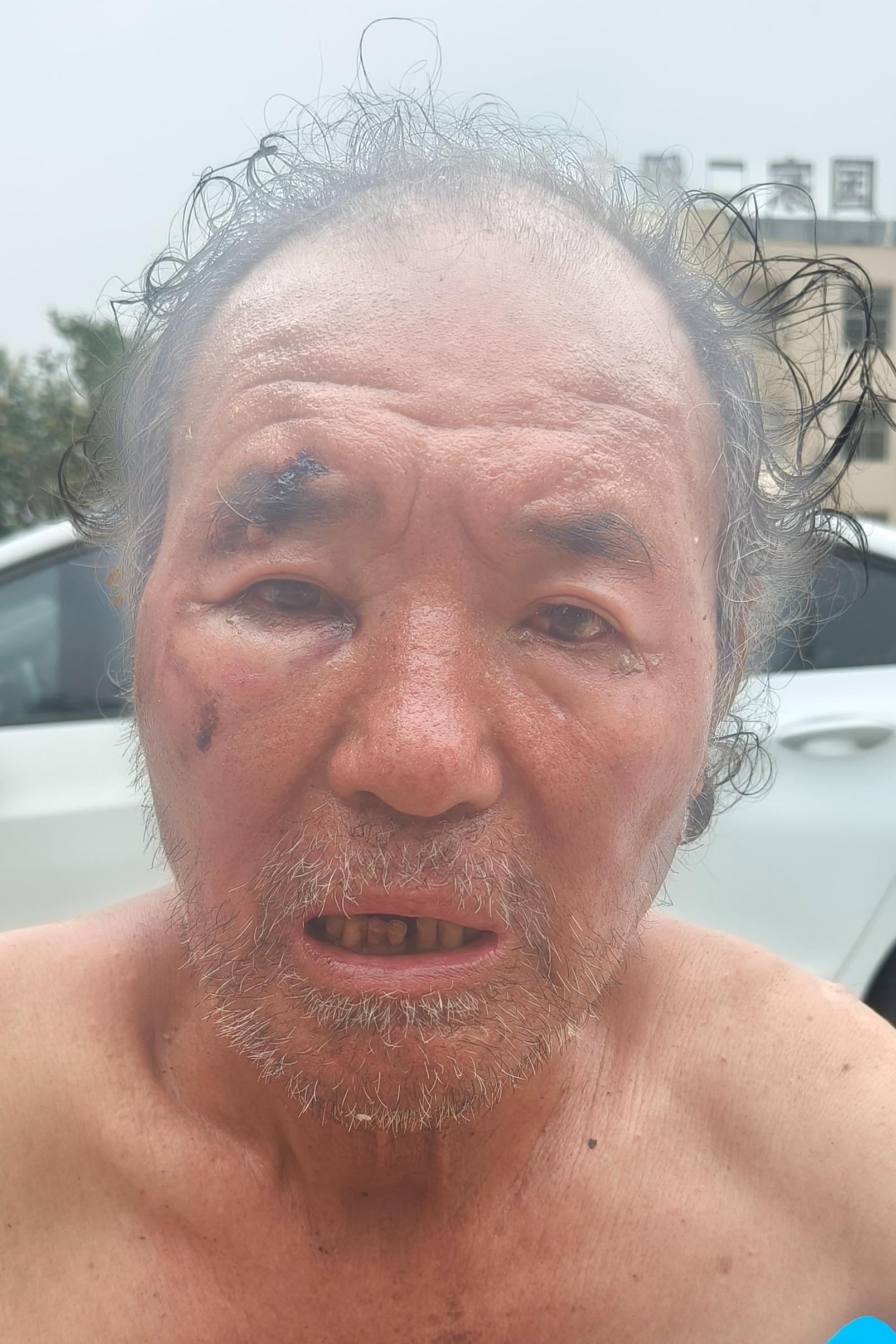 走失者照片 全国救助站