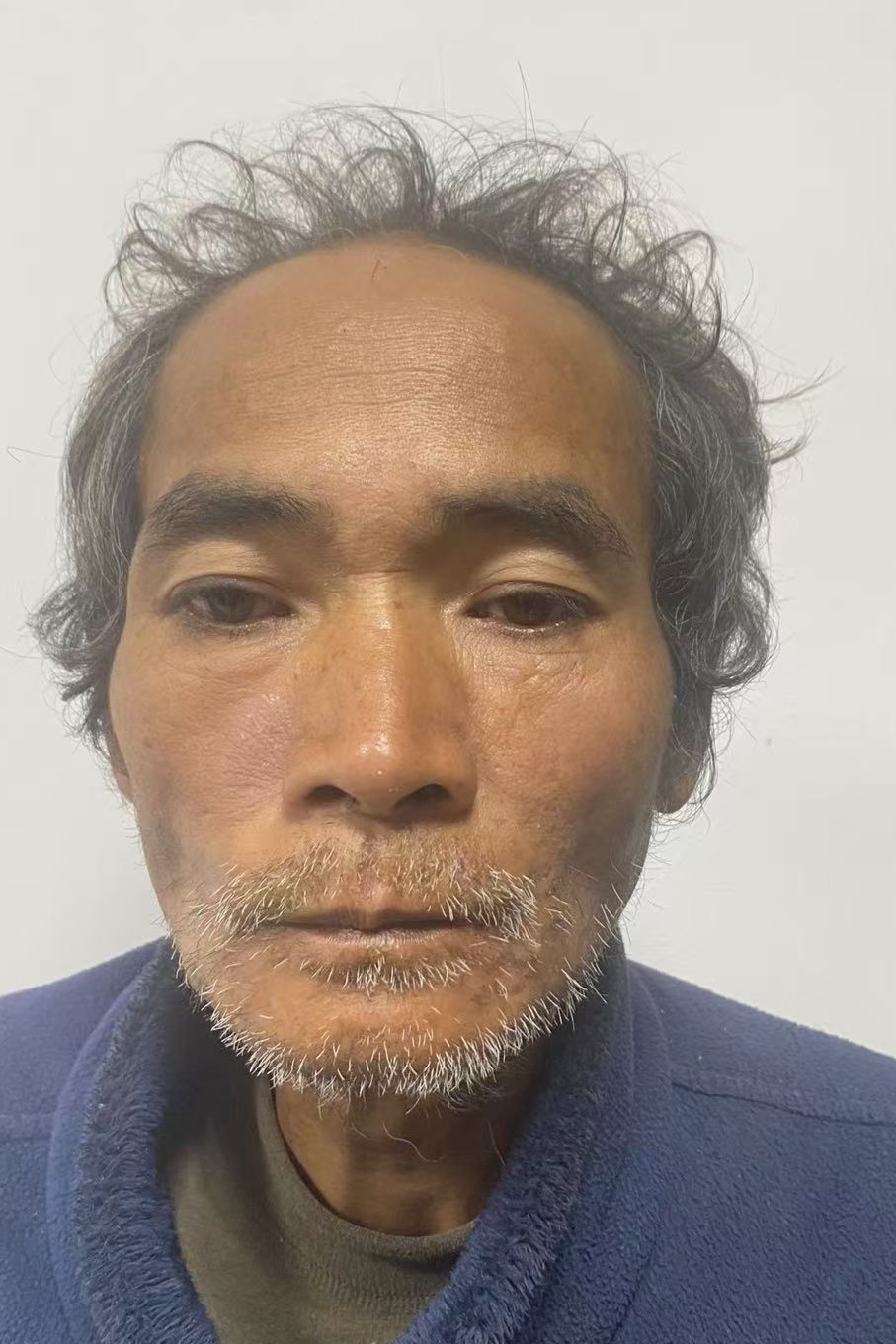 走失者照片 全国救助站