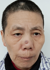 走失者照片 全国救助站
