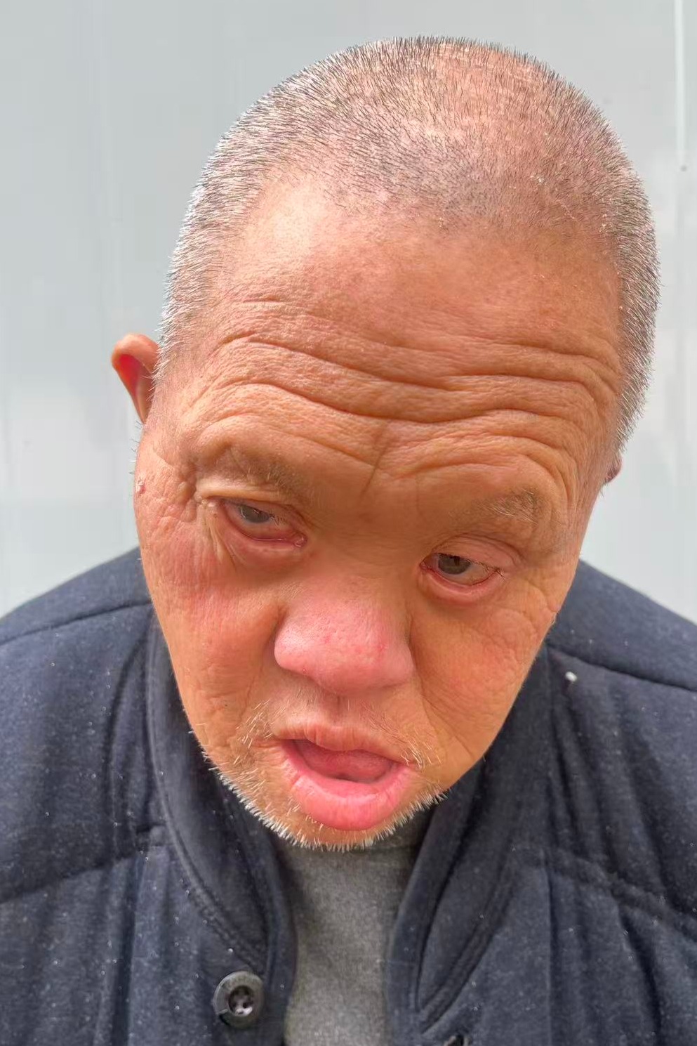走失者照片 全国救助站
