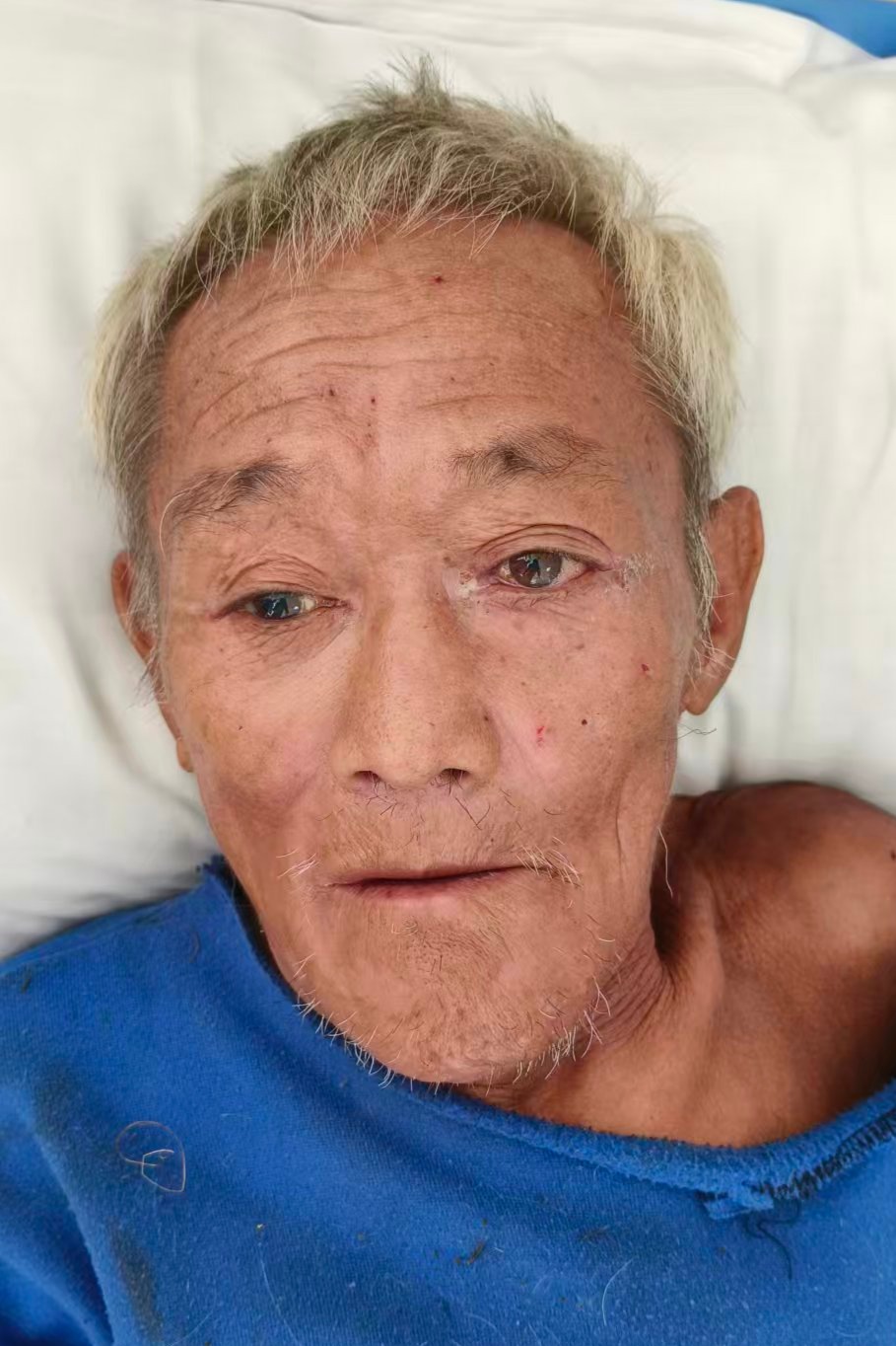 走失者照片 全国救助站