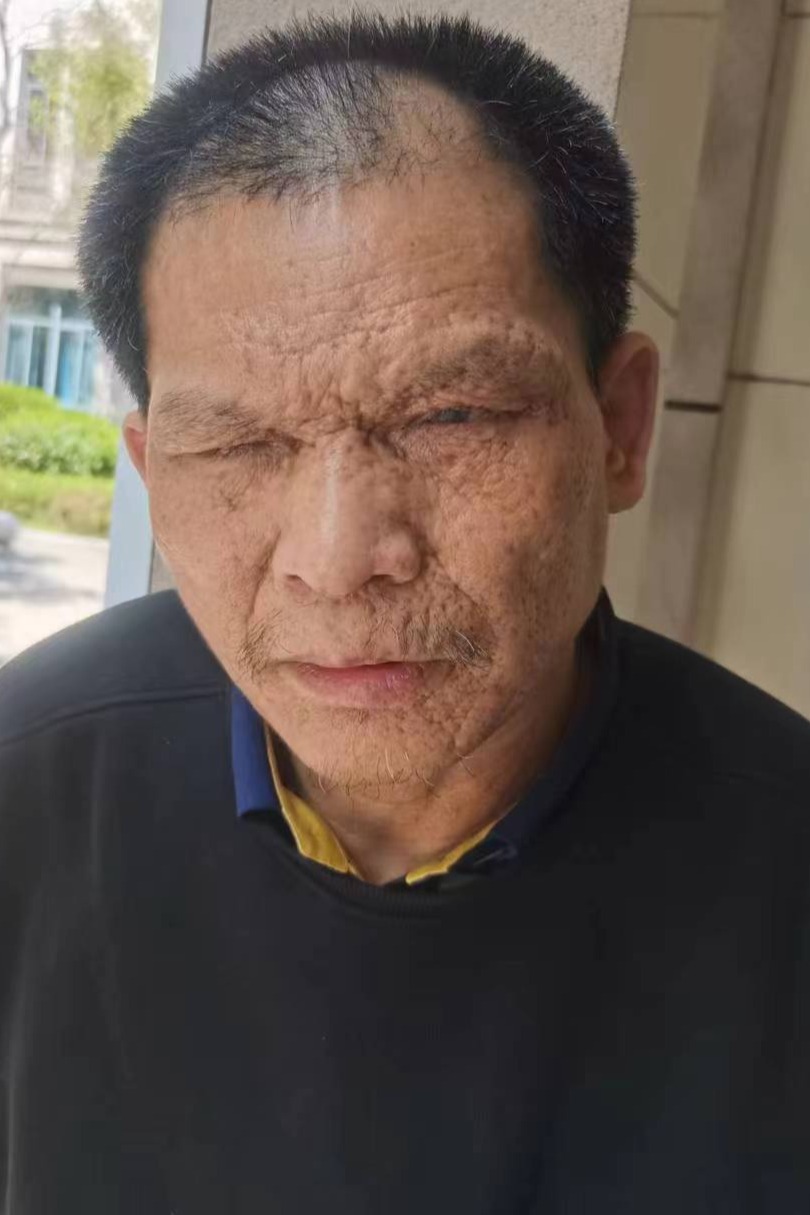 走失者照片 全国救助站