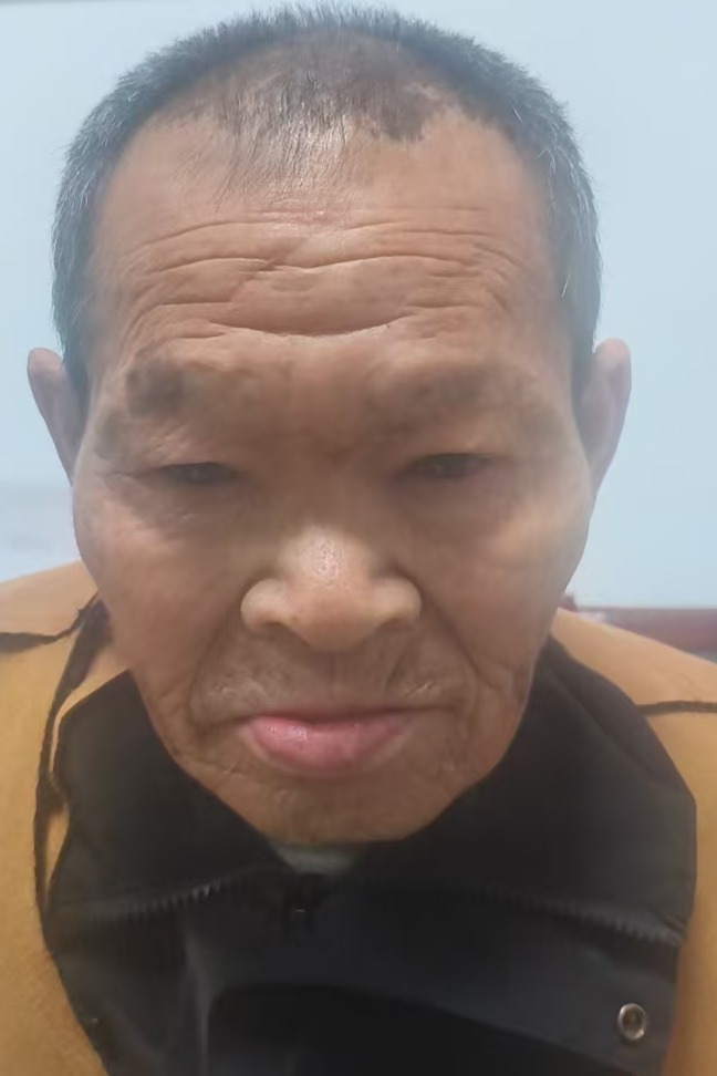走失者照片 全国救助站