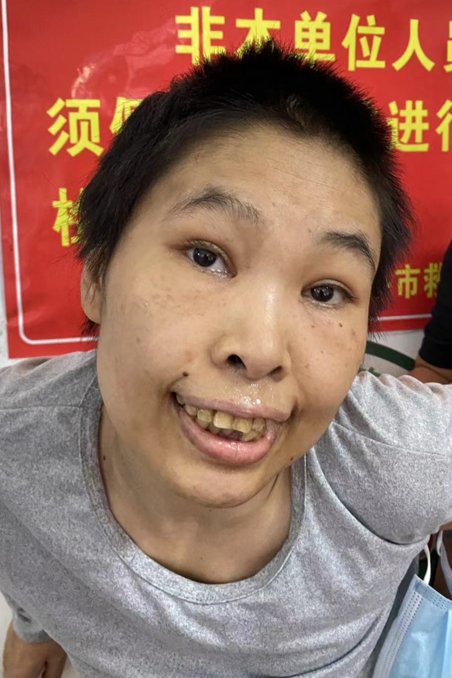 走失者照片 全国救助站