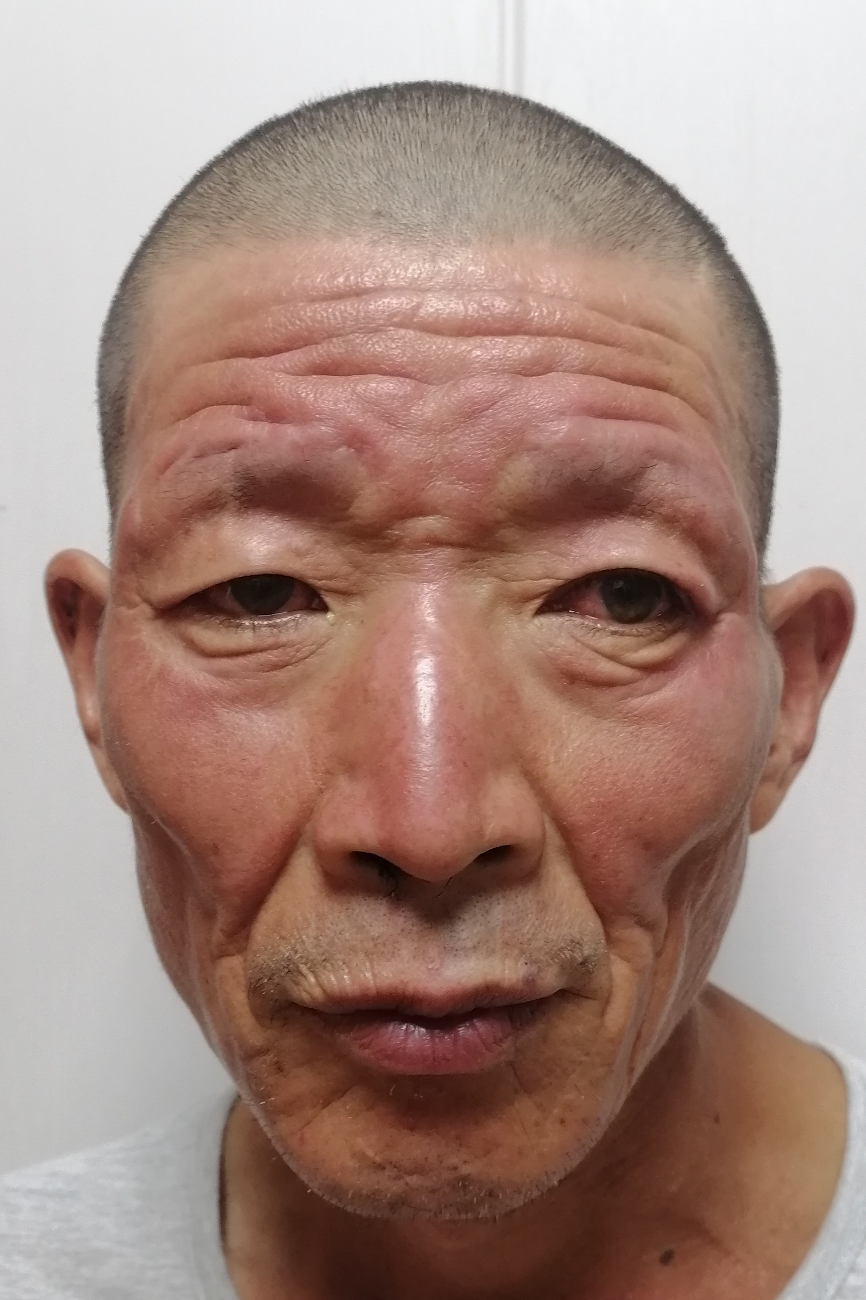 走失者照片 全国救助站