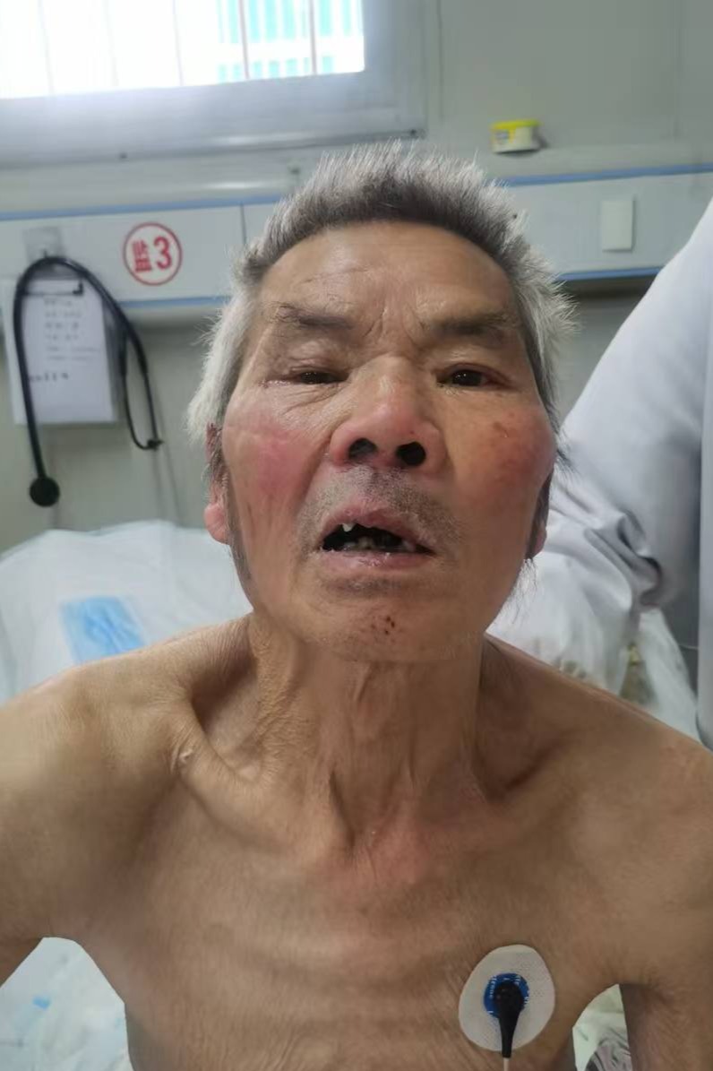 走失者照片 全国救助站