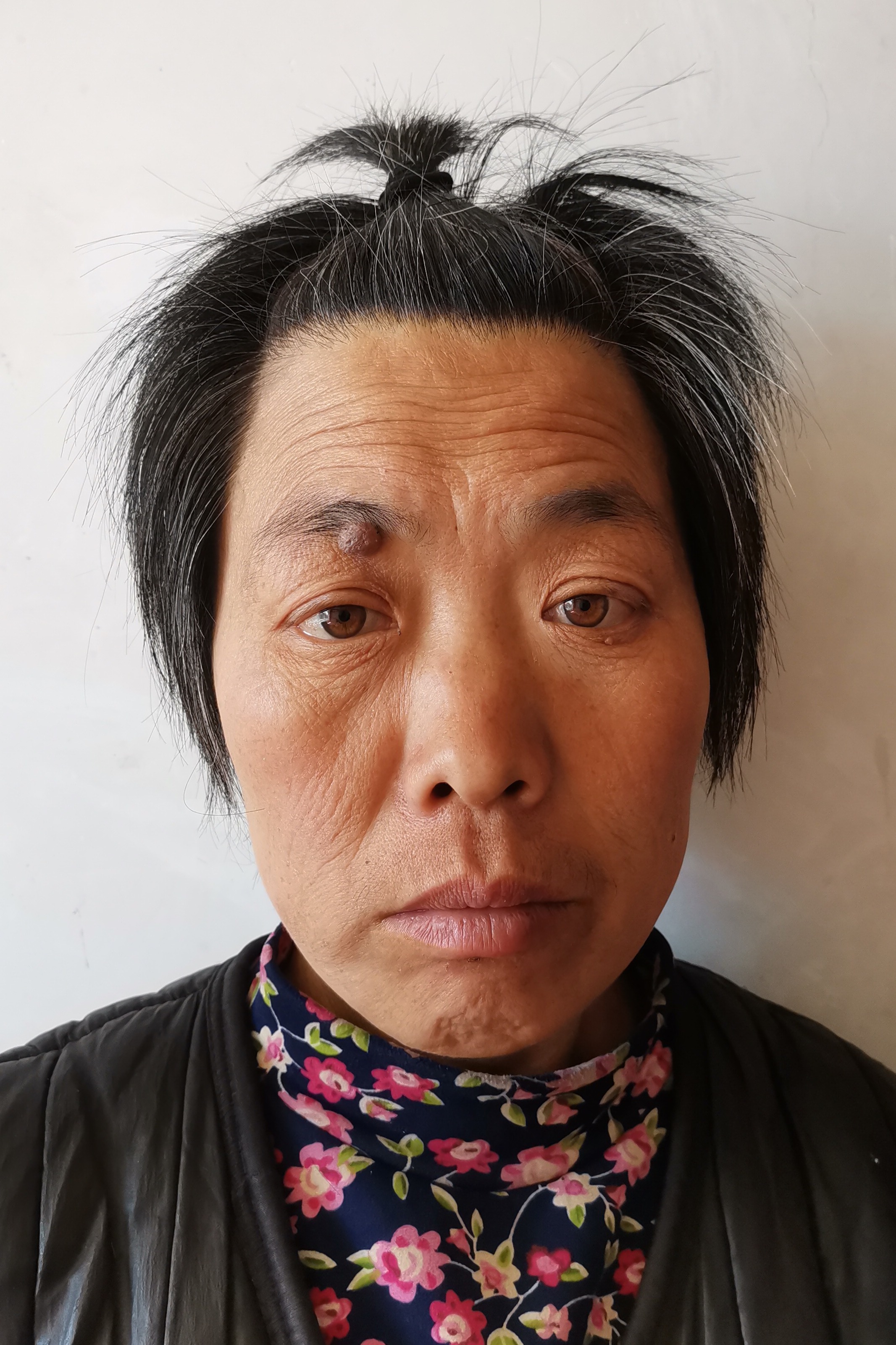 走失者照片 全国救助站