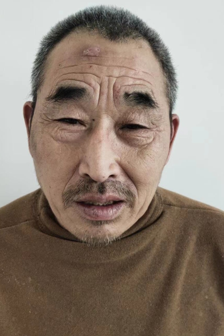 走失者照片 全国救助站