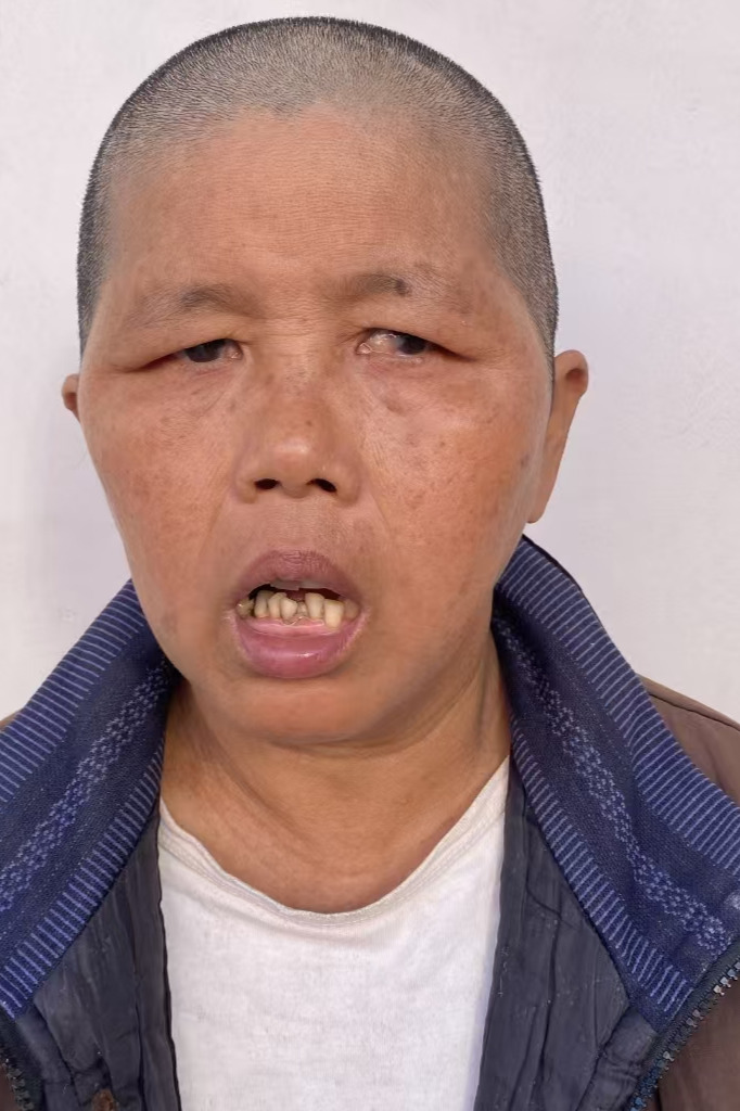 走失者照片 全国救助站