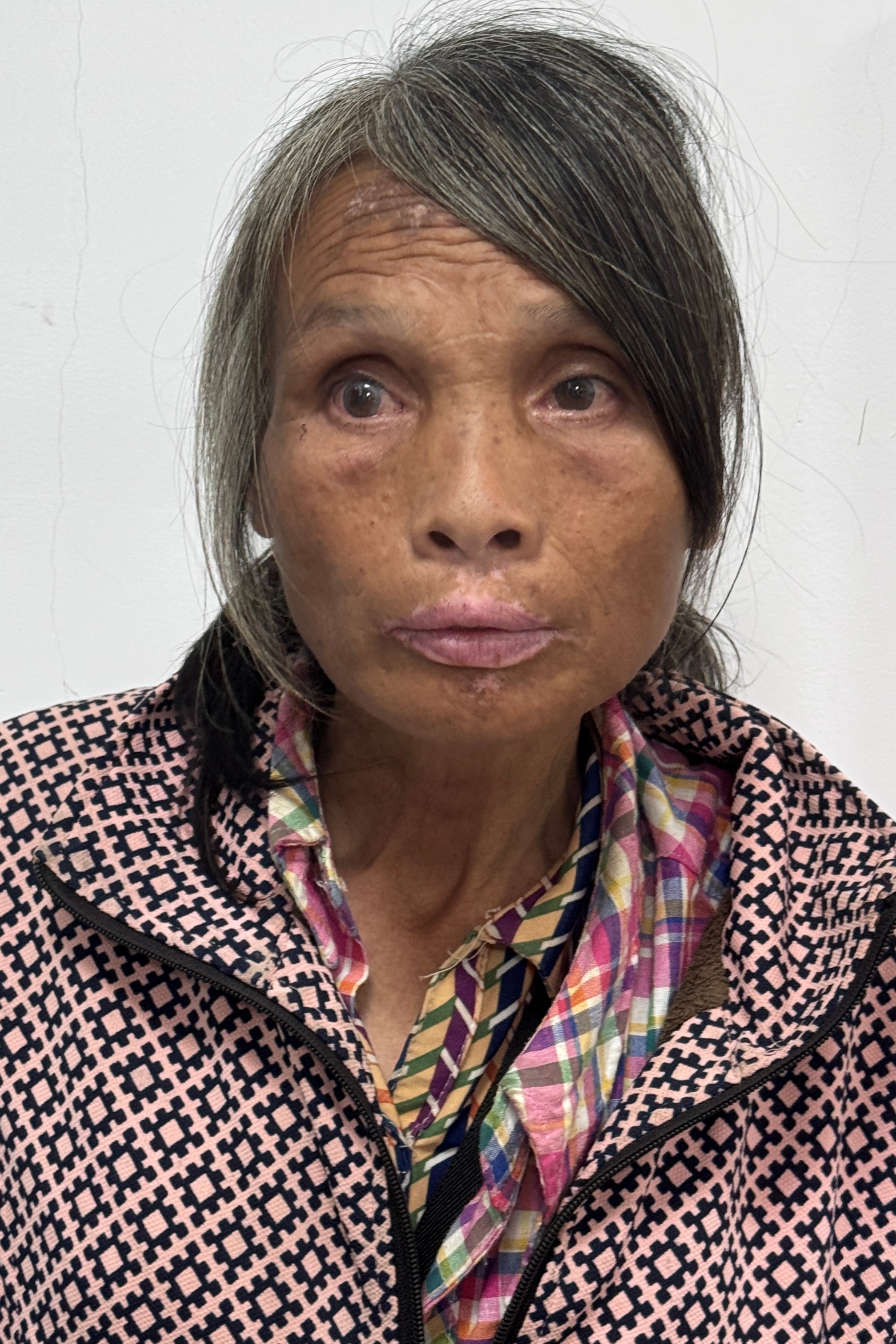 走失者照片 全国救助站