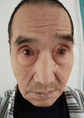 走失者照片 全国救助站
