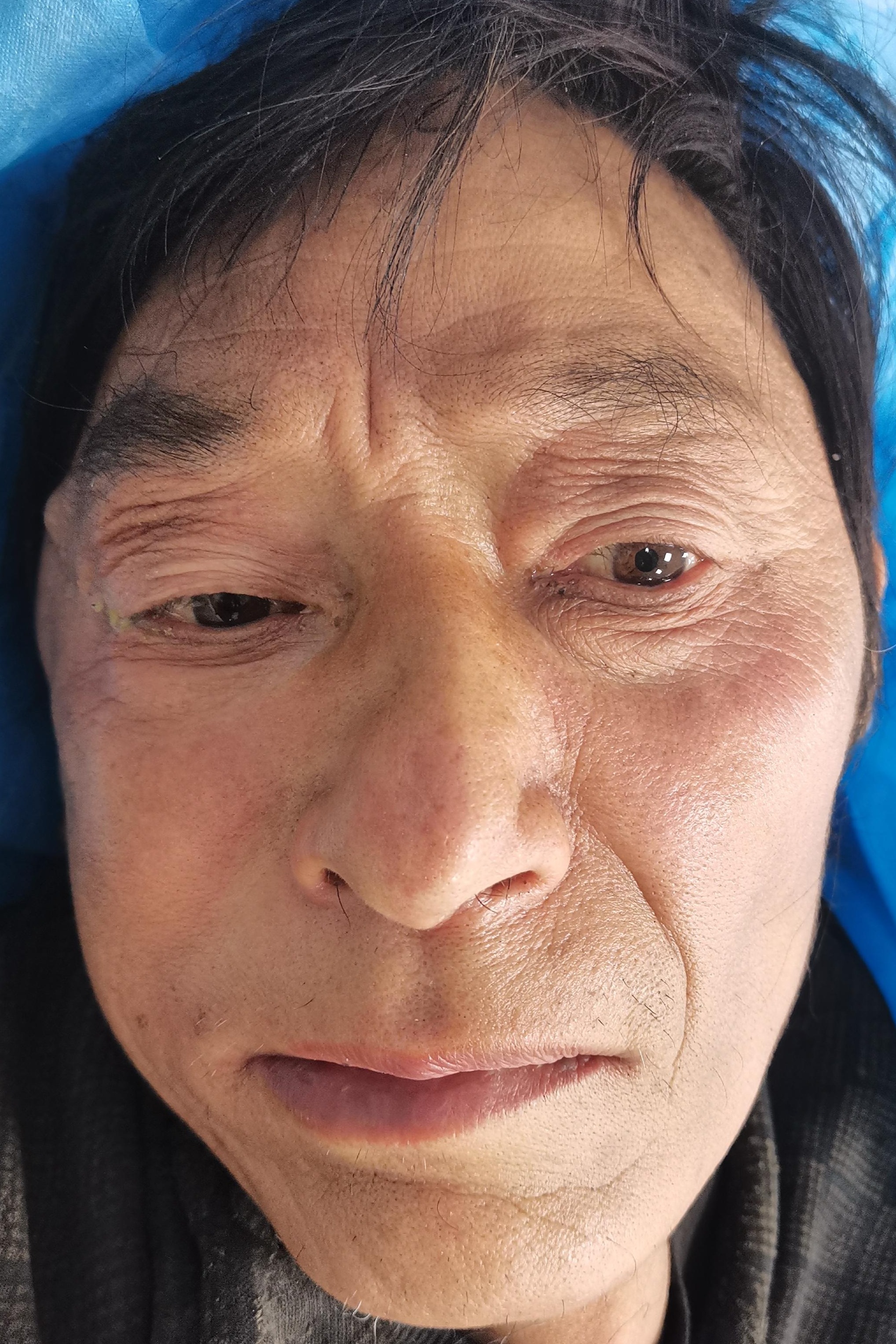 走失者照片 全国救助站