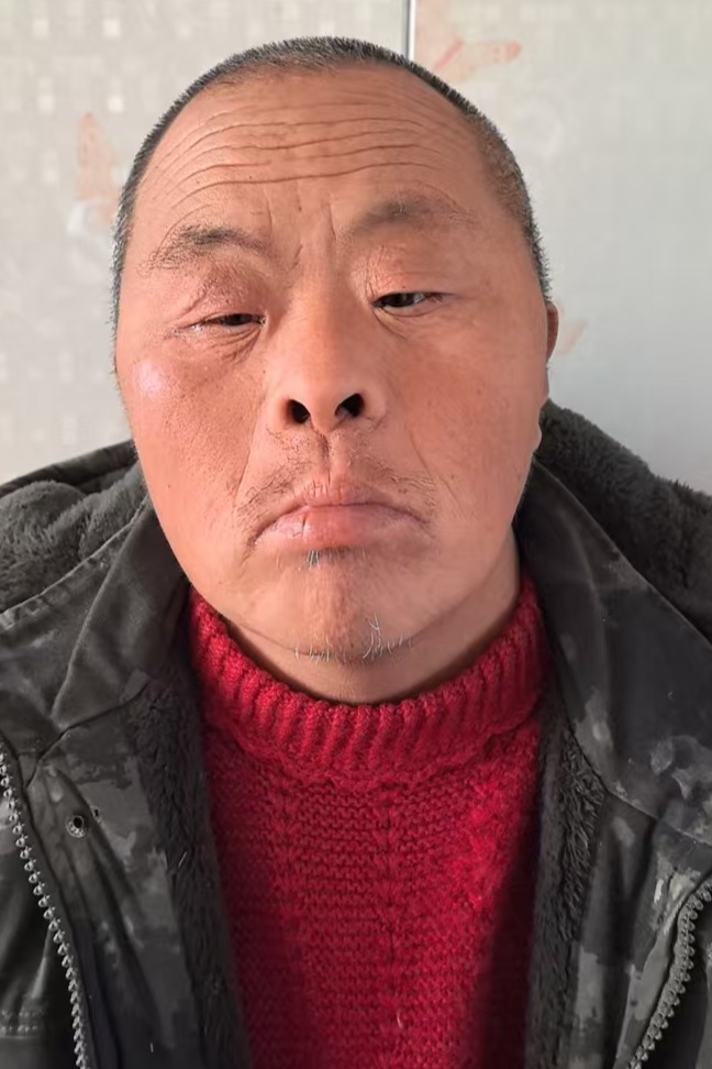 走失者照片 全国救助站