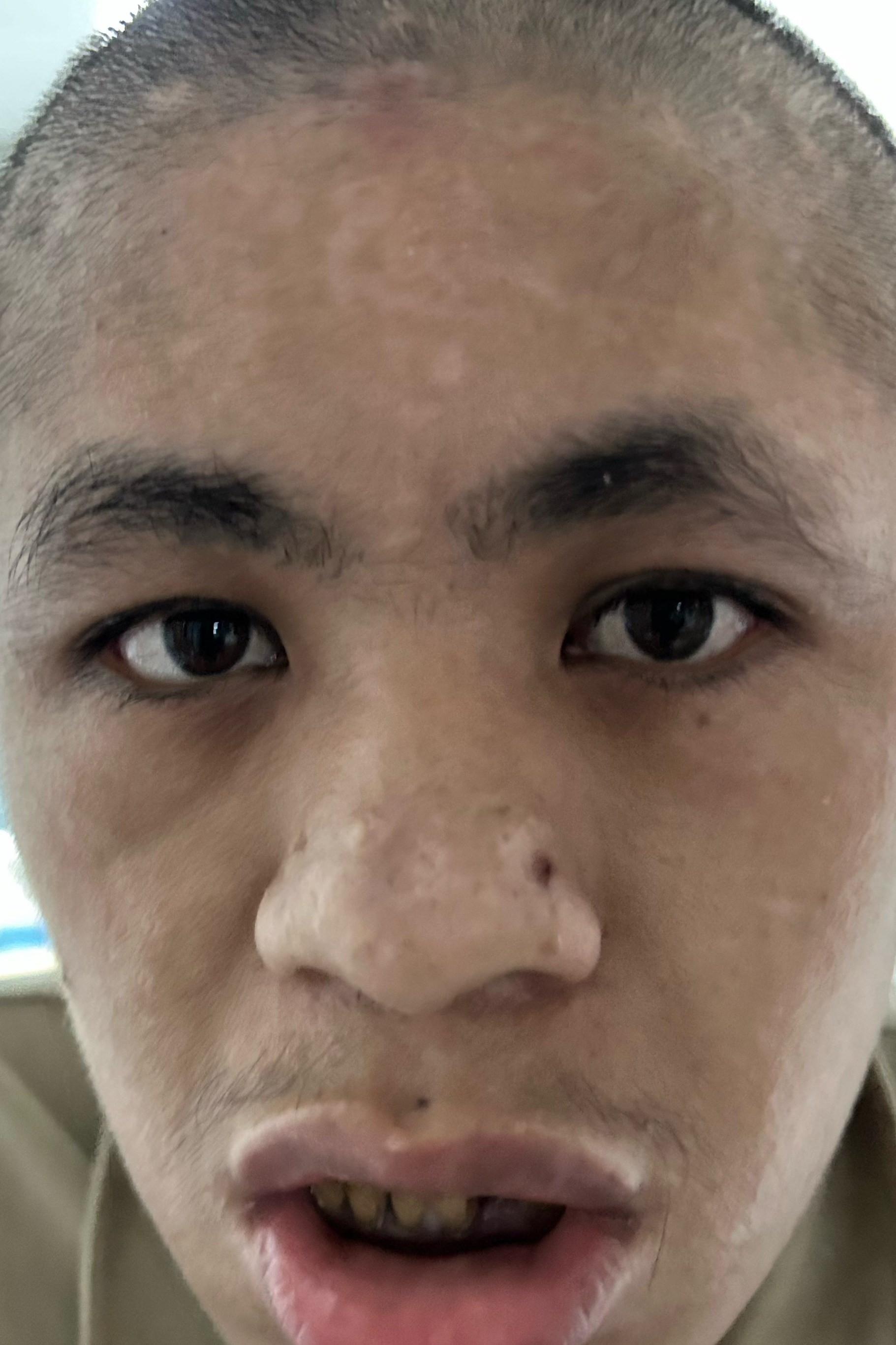 走失者照片 全国救助站
