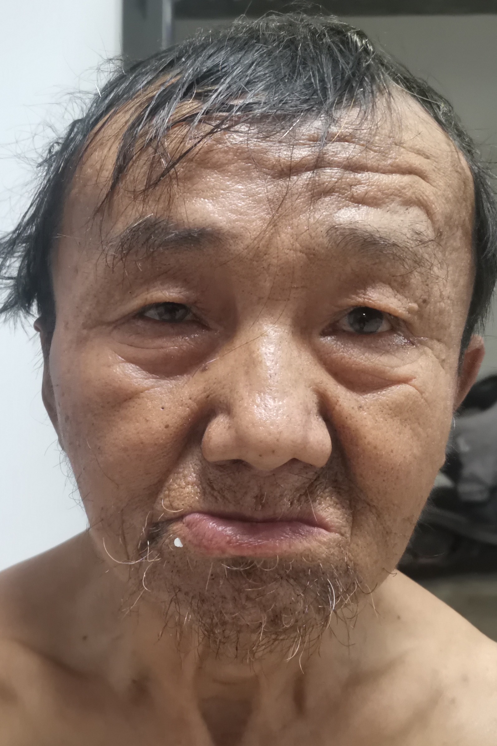 走失者照片 全国救助站